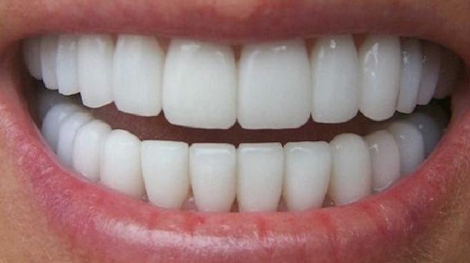 Rêver de dents